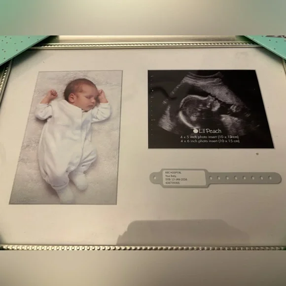 Ultrasound & bracelet frame. - Picture 1 of 4